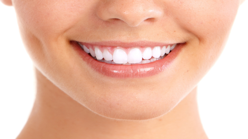 Why Choose Teeth Whitening In Castle Hill